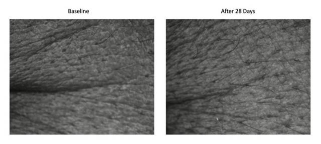Visioscan® Surface Evaluation Clinical Study – Delavie Sciences