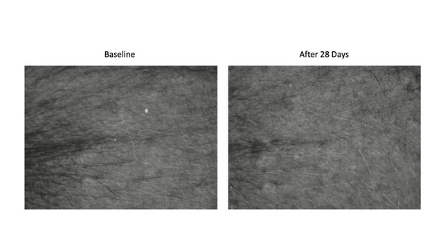 Visioscan® Surface Evaluation Clinical Study – Delavie Sciences