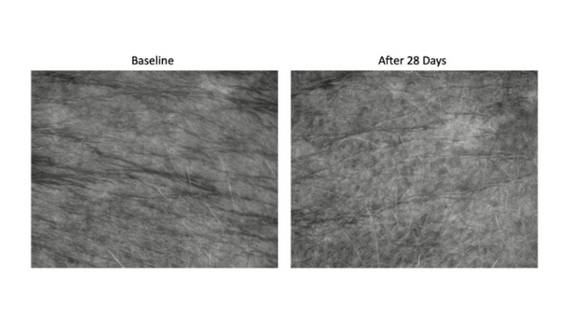 Visioscan® Surface Evaluation Clinical Study – Delavie Sciences