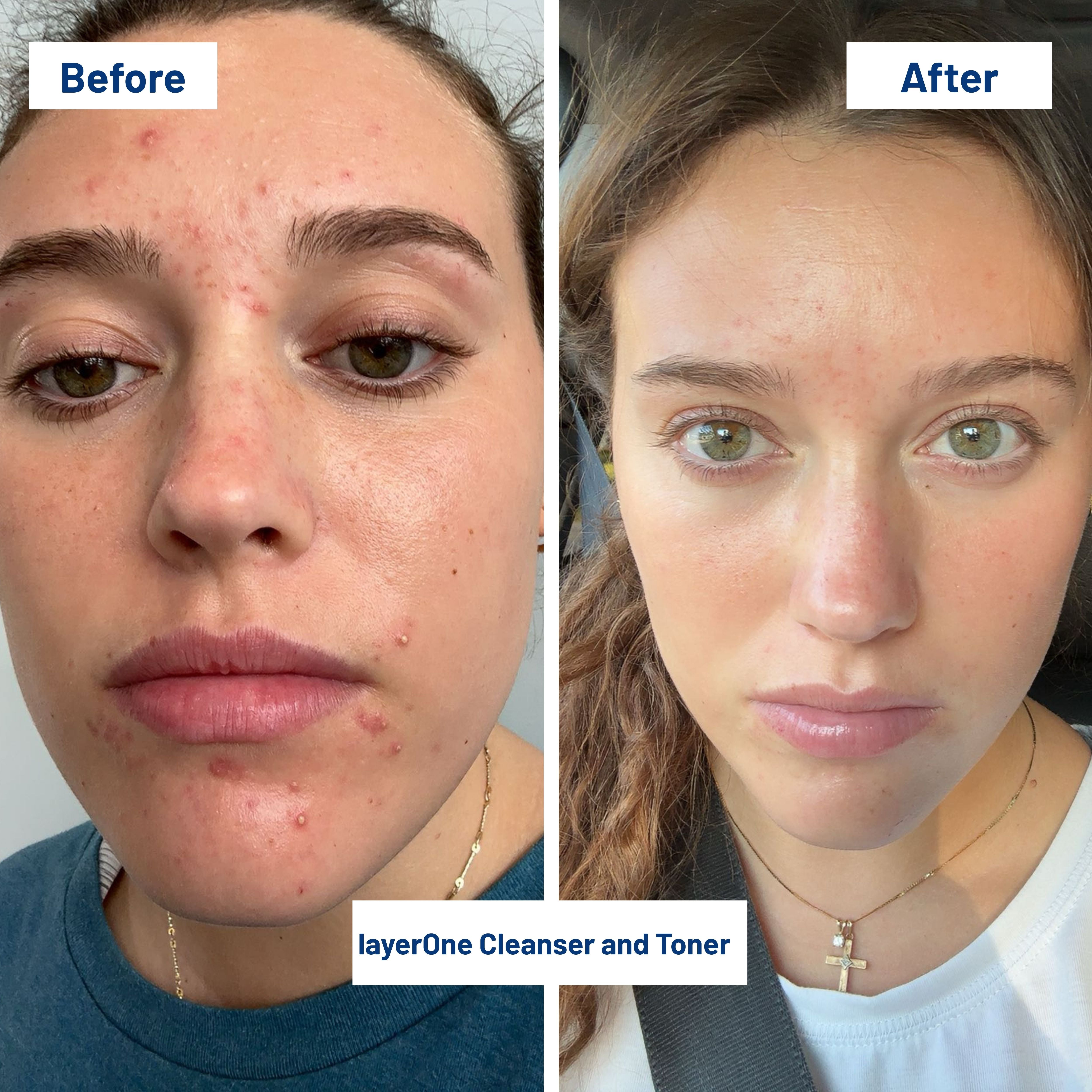 ボディ・フェイスケア LANN layerOne Clarifying Enzyme Cleanser – Delavie Sciences