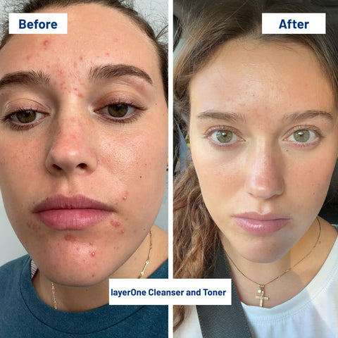 layerOne Clarifying Enzyme Toner